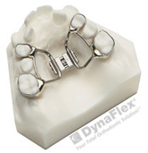 Palatal Expander